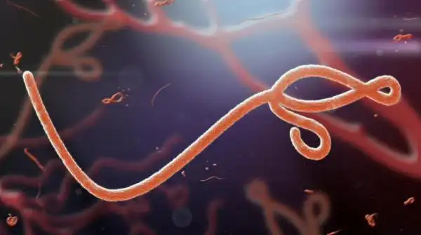 Domain investor sells  Ebola.com for $200,000