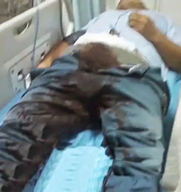 Photo: Man Cuts Of His Own P*nis Because Girlfriend Says He Wasn’t Good Enough In Bed