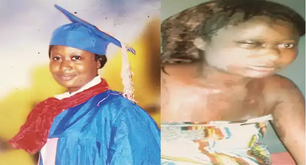 Photos: Jilted Man Bathes Ex-lover With Acid In Lagos 