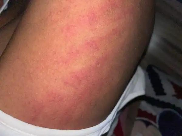 "I just gave birth to twins through CS and my husband has beaten me twice" - Nigerian woman cries out for help