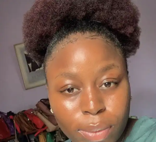 Lady Called ‘4:30’ Eyes And Bullied Because Of Her Crossed Eyes Shows Incredible Transformation (Photos)