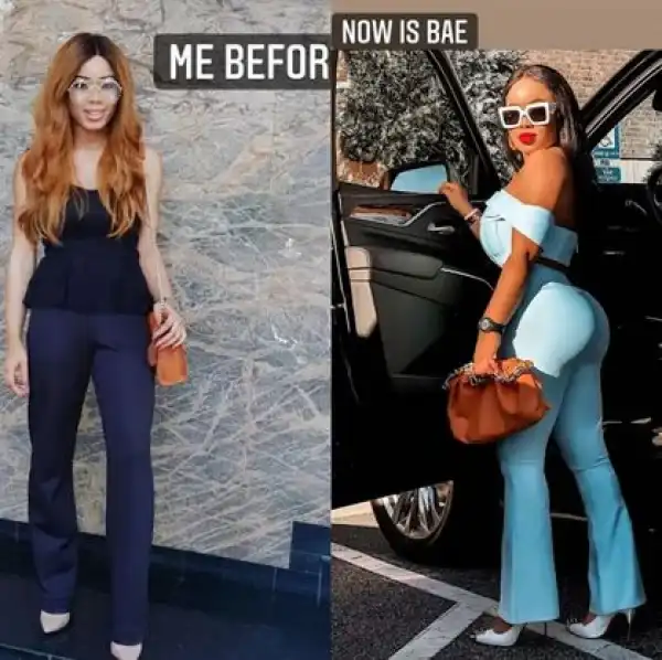 Former BBNaija Housemate, Nina Ivy Shares Before And After Surgery Photos