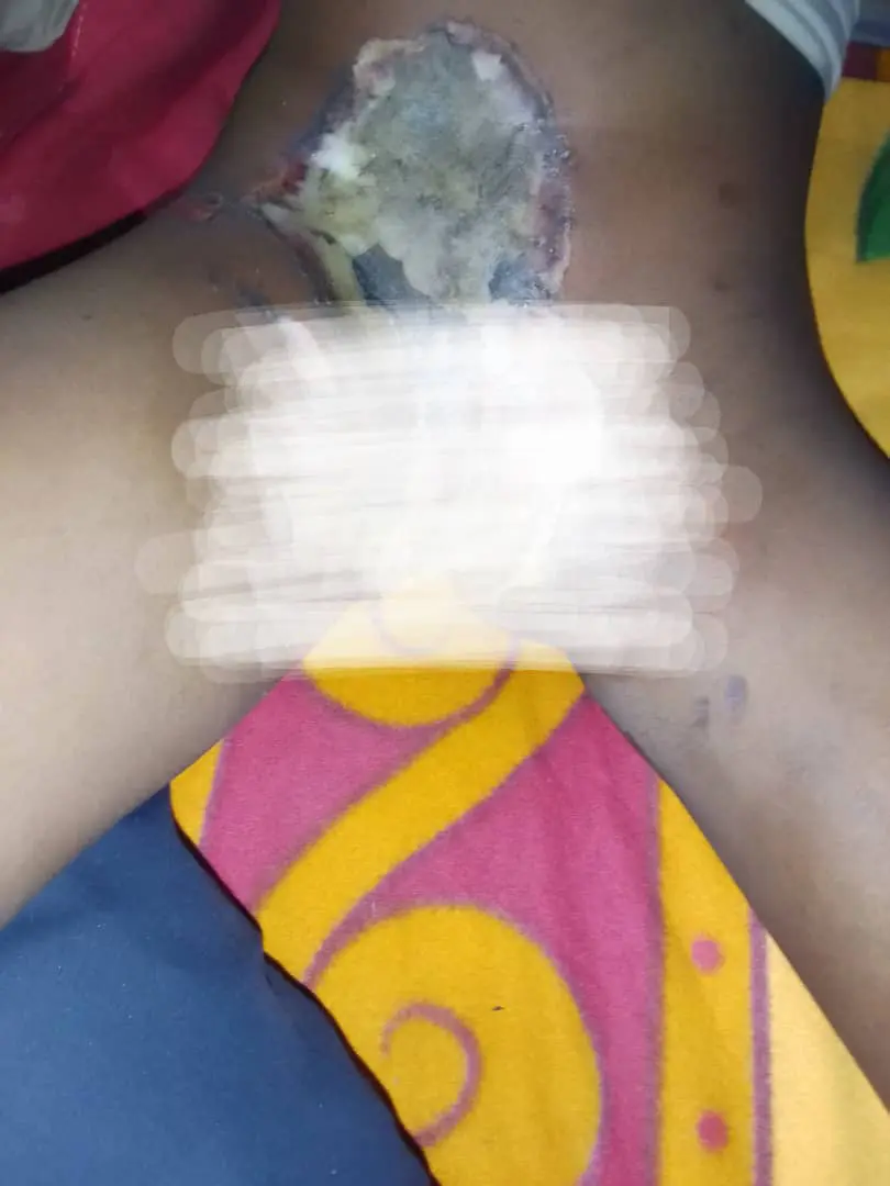 Bauchi housewife burns minor’s private part with hot knife