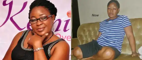 “I Just Want to Be Healed” – Actress Omotunde Ogundimu Reveals Cervical Cancer Battle, Begs Nigerians for Help