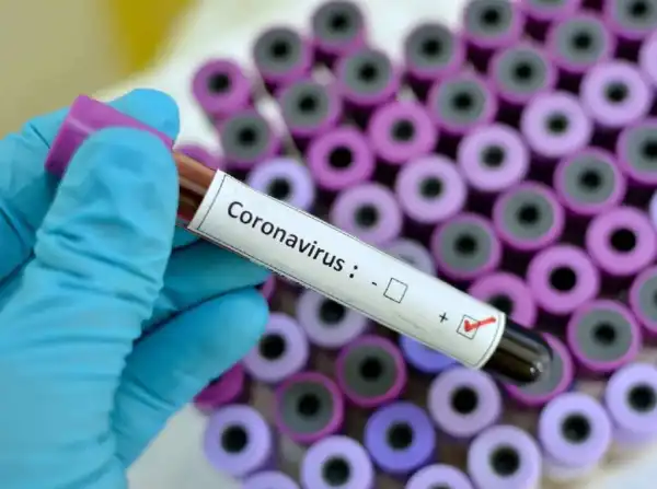 FEC approves N8.49bn for 12 COVID-19 testing items
