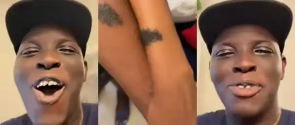 Man Discovers His Friend And Girlfriend Share Identical Birthmark