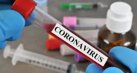Adamawa records first case of COVID-19