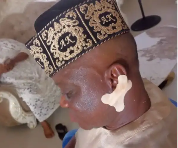 Community chief attacks monarch in Ondo, bites his ears