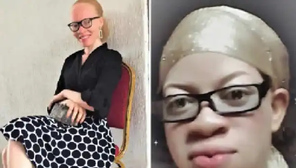 Albinism group seeks action against discrimination