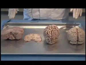 Atmosphere - Blotter Acid Reflux Syndrome (Video)