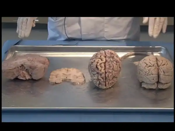 Atmosphere - Blotter Acid Reflux Syndrome (Video)