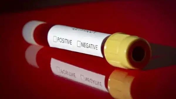 Over  15 test negative in Borno