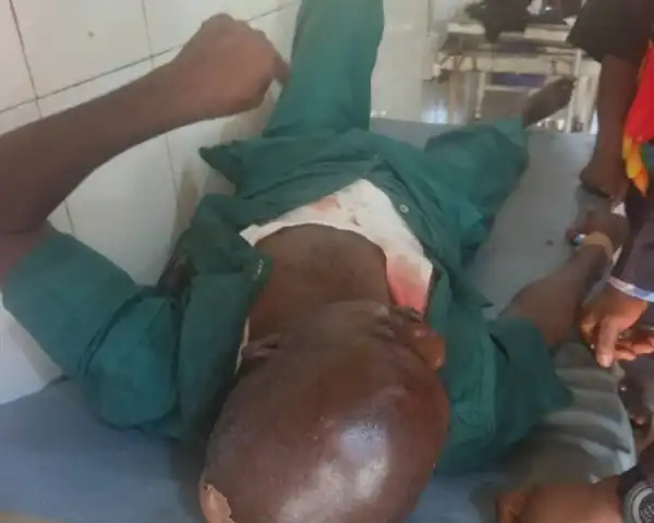 APC chieftain hospitalised after alleged attack by thugs in Delta