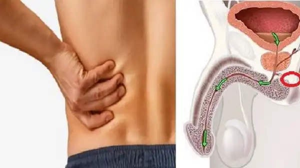 5 early symptoms of cancer in men