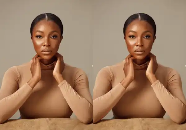 Ini Dima-Okojie opens up on how hormonal acne affected her confidence