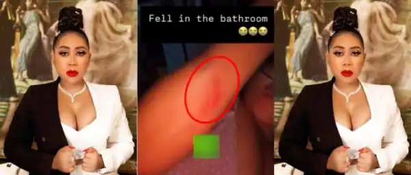 “Thank God I’m Alive”- Moyo Lawal Emotionally Recounts Bathroom Accident