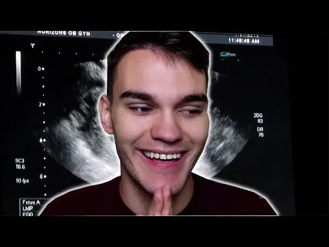 Biography & Career Of Ivan Magla