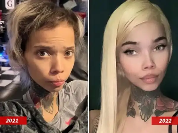 IG Model Goes Blind After Eye Surgery (Photo)