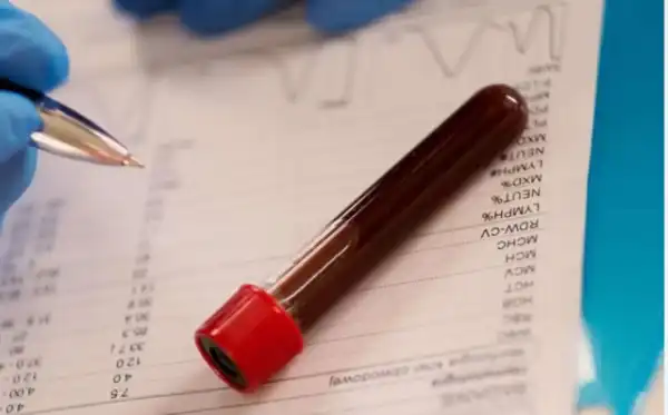 Why post-2021 Ukraine medical degrees will not be recognised – MDCN