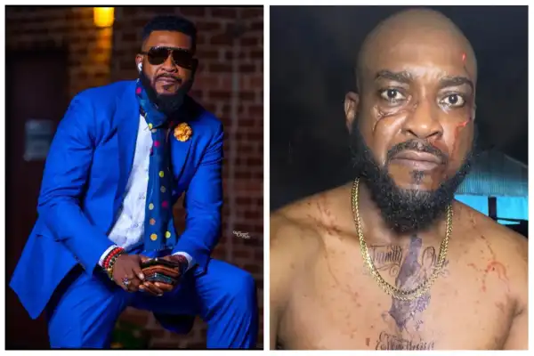 Actor Chidi Mokeme Reveals He Has Been Battling An Incurable Ailment