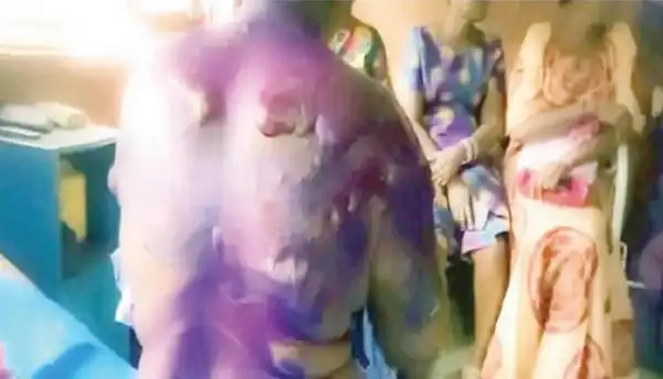 Landlady bathed me with hot, peppered water over rent – Anambra woman