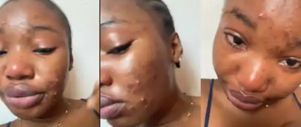 “I Hate Having Acne” – Mirabelle Shares Emotional Experience After Public Insult From Stranger