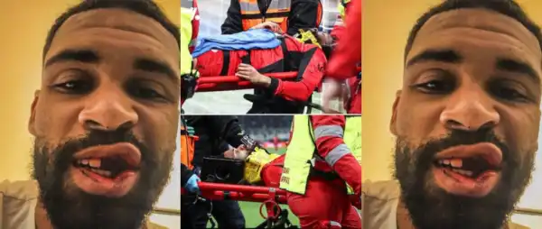 Ex-England Star Loftus-Cheek Hospitalized After Serious Injury in Milan Defeat