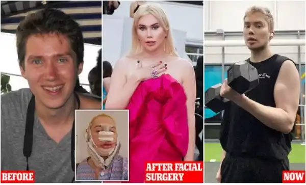 Influencer de-transitioning from a trans woman back to a man after realising he was happier as a man