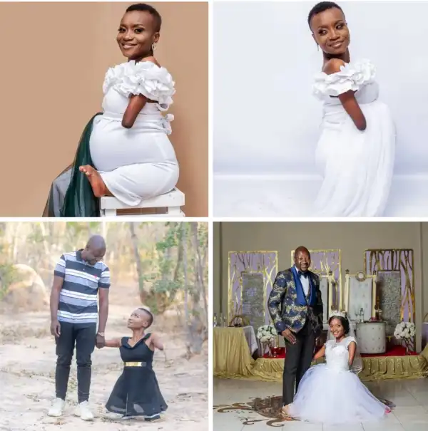 Zimbabwean woman born without limbs expecting first child with her husband