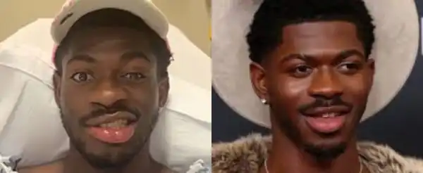 Lil Nas X says one side of his face is paralyzed