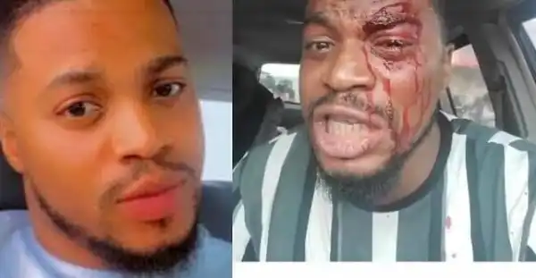 Drama As Area Boys In Lagos Attack Actor, Akeem Adeyemi, At Movie Location