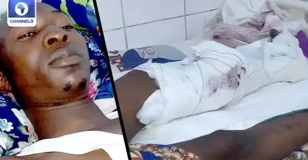 Tailor Shot By DSS Operative Narrates Ordeal