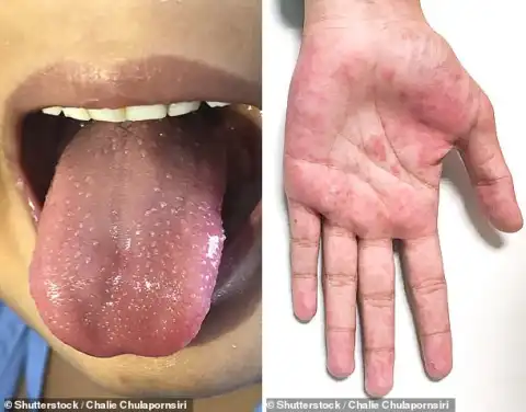 NHS issues urgent alert as children are being admitted to intensive care with a new Coronavirus-related 'inflammatory syndrome' (photo)