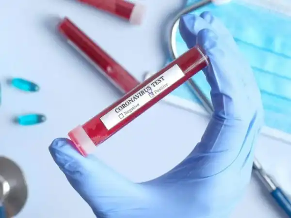 Oyo records 26 fresh COVID-19 cases, Ogun State has zero