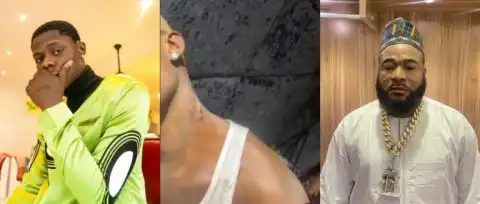 Mohbad: Fans Dig Up Old Videos Of Singer Showing Injuries Inflicted On Him By Sam Larry