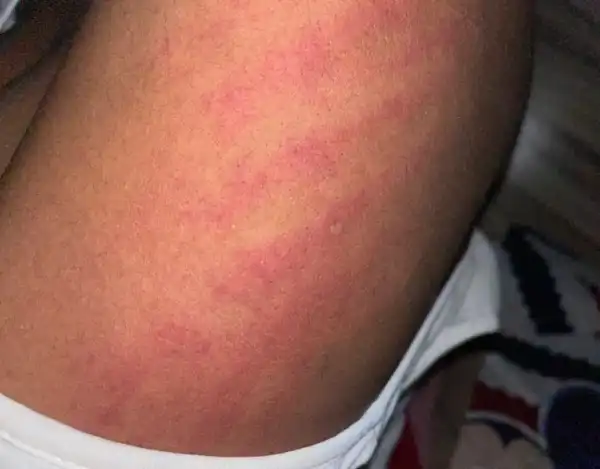 I Just Gave Birth To Twins Through CS And My Husband Has Beaten Me Twice - Nigerian Woman Cries Out