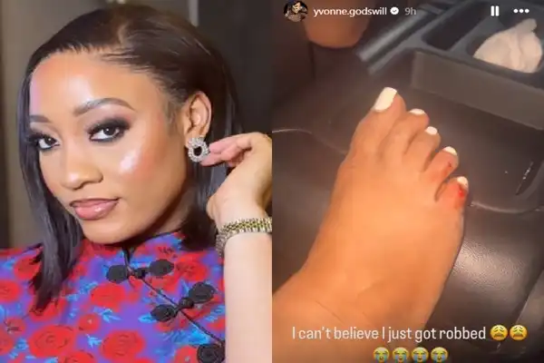 BBTitan Star, Yvonne Recounts Robbery Attack (Photo)