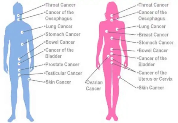 Pfizer laments inadequate cancer treatment centres in Nigeria