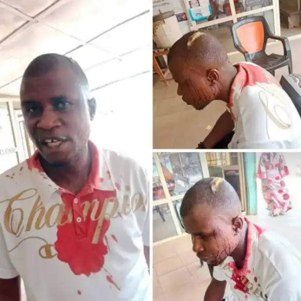 NSCDC To Punish Officers For Brutalising Journalist In Nasarawa