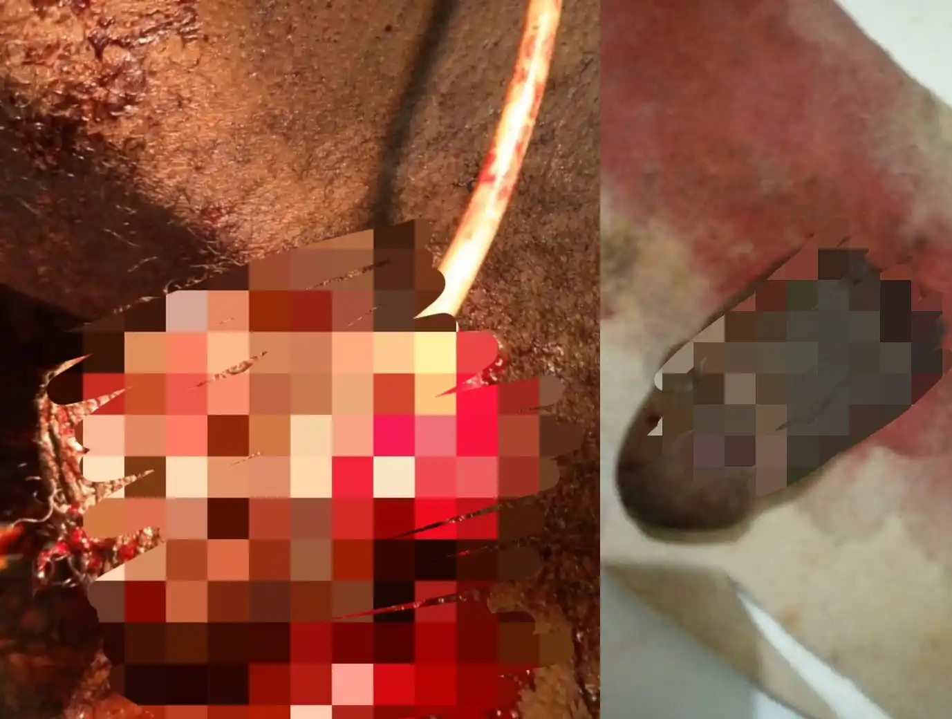 Identity of pregnant woman who chopped of her husband