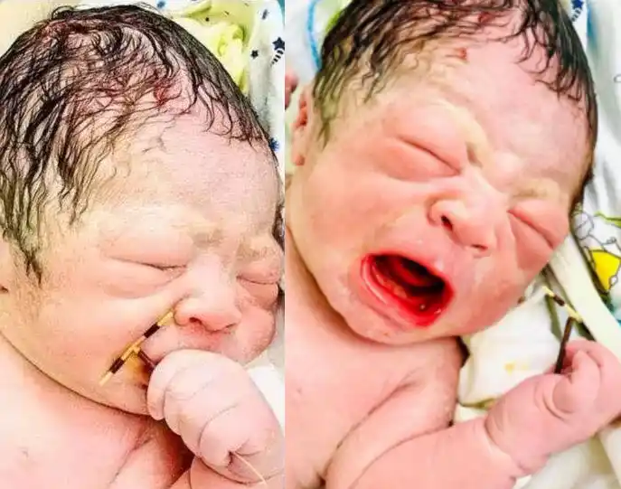 Baby is born holding his mother