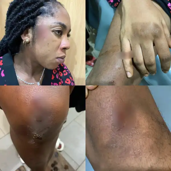 Actress, Amarachi Igidimbah Recounts How She Almost Died While Being Rushed To The Hospital To Give Birth