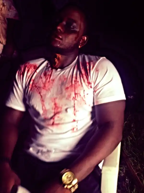 BREAKING NEWS!: Singer OmoAkin Attacked By Wild Animal | GRAPHIC PHOTO