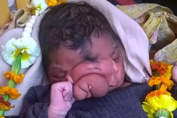 Girl Born With 
