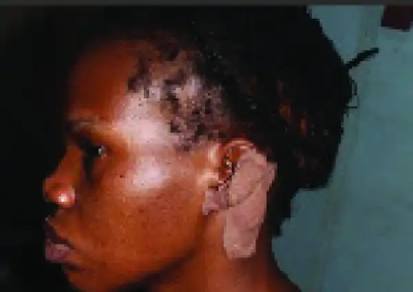 Nurse narrates how her security guard connived with robbers to attack her home