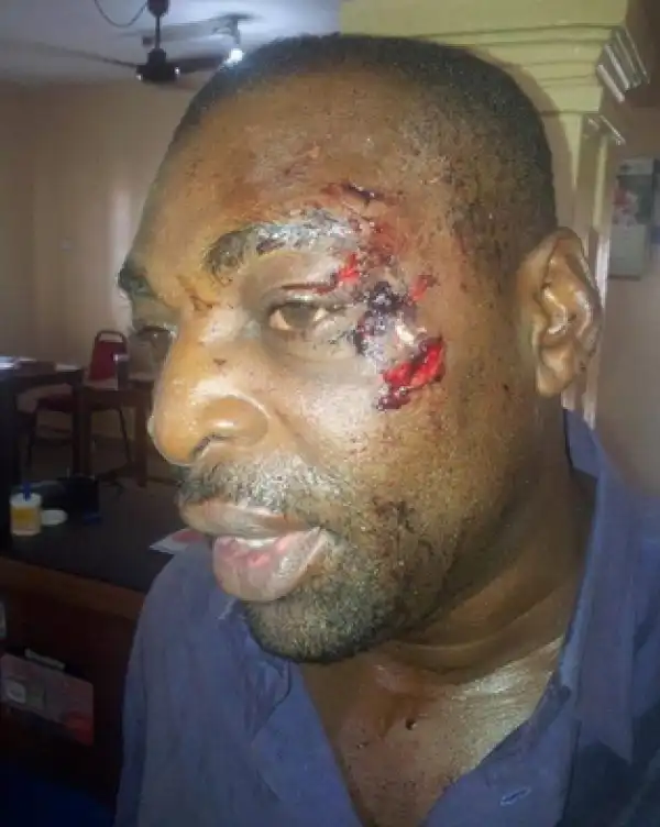 Thugs Assault APC Campaign Coordinator In Akwa Ibom