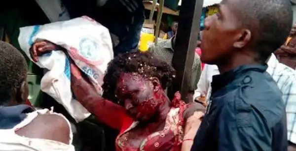 Very Graphic Photos Of Victims Of Borno Bomb Blast 