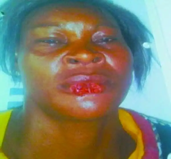 Woman bites off another woman