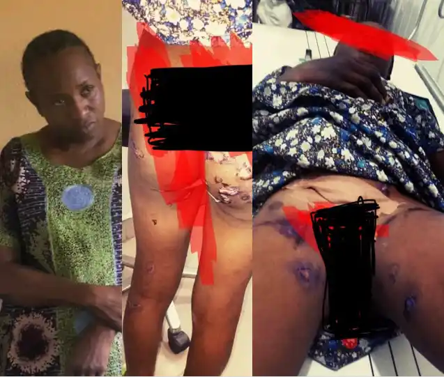 Deaconess arrested for allegedly subjecting her ward to extreme torture, including burning her vagina and butt with lighter and inserting hot sticks before rubbing pepper in it (photos)