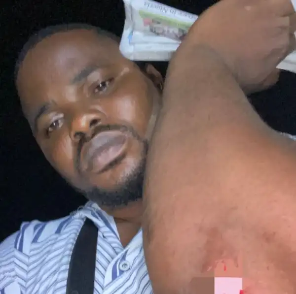 Journalist Eniola Daniel Suffers Injuries As He Escapes Being Abducted